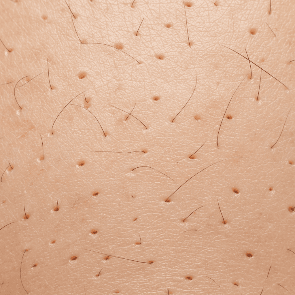 Close-up view of a human scalp showing hair follicles and skin texture